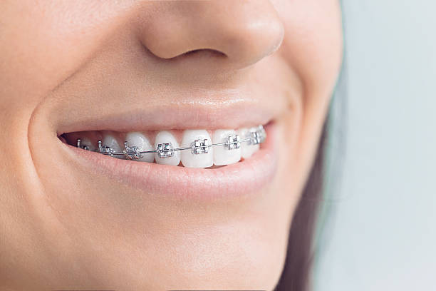 Dental Inlays and Onlays in Pirtleville, AZ